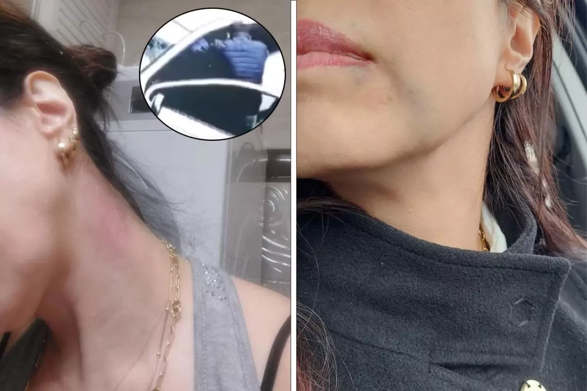 Astım hastası kadını öldüresiye dövdüler: “Beni öldü zannedip kaçtılar”